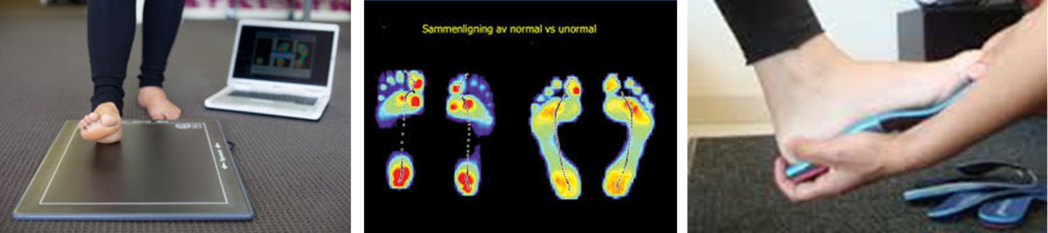 gait scan